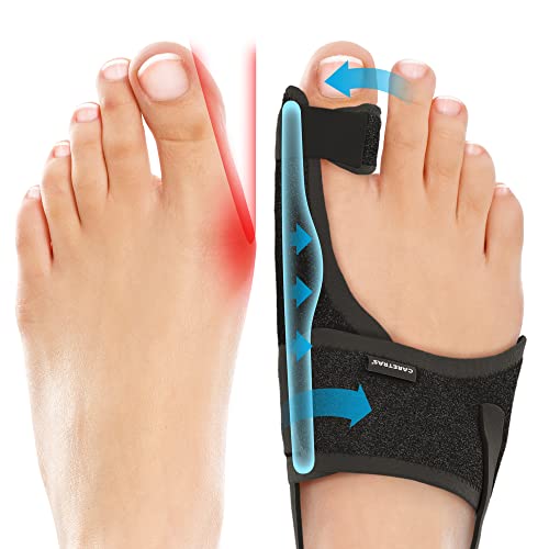 Caretras Bunion Corrector for Women & Men, Hammer Toe Straightener L&R Pair | Orthopedic Bunion Splint for Hallux Valgus Pain Relief, Big Toe Separator, Adjustable and Comfortable Day/Night Support