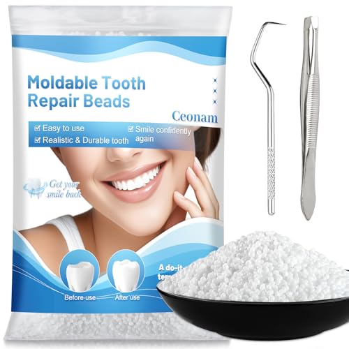 10.9 oz Tooth Repair Beads Kit for Temporary Missing and Broken Teeth