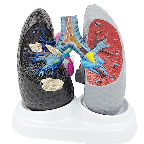 Lung Healthy Lung Model,Breathing Lung and Bronchial Teaching Aids Human Visceral Respiratory Theory Comparison Demonstration Skeleton Model