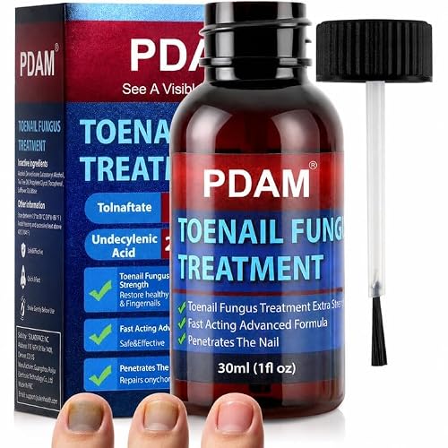 Toenail Fungus Treatment Extra Strength - Maximum OTC with 25% Undecylenic Acid